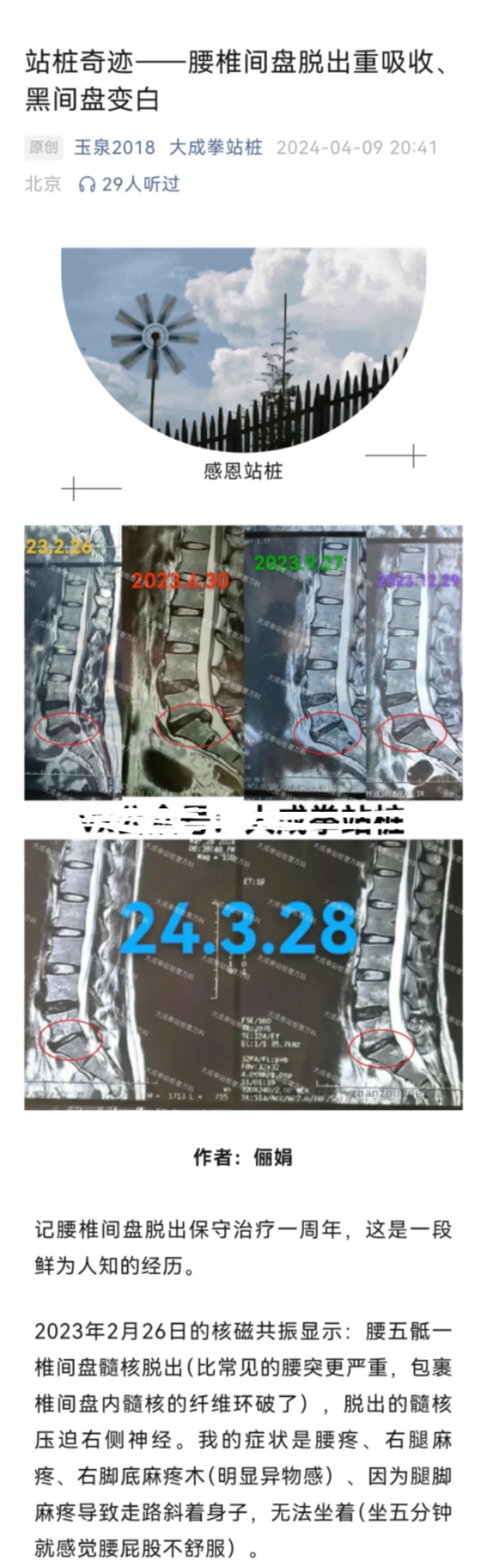 特雷-曼腰椎间盘突出伤病完全恢复，已参加对抗训练的简单介绍